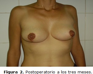 figura 2