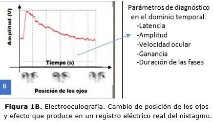 figura 1B