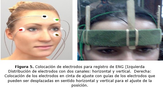 figura 5