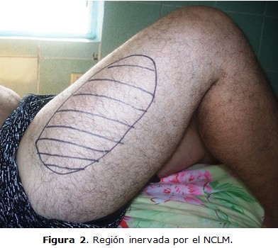 figura 2