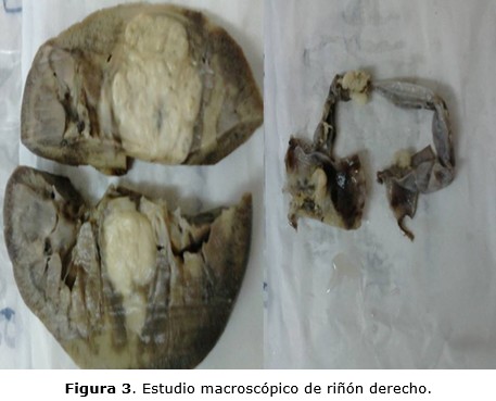 figura 3