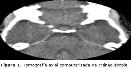 figura 1