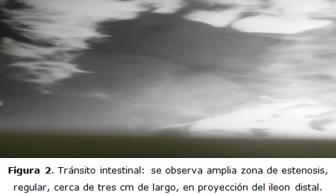 Figura 2