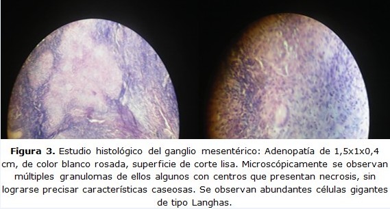 Figura 3