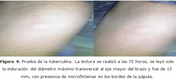 Figura 4