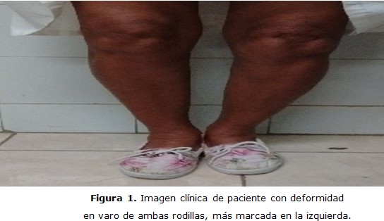 figura 1