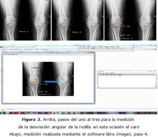 figura 2