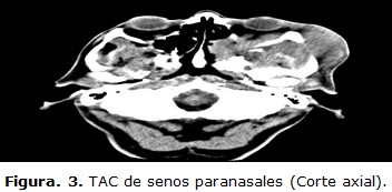 figura 3