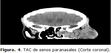 figura 4