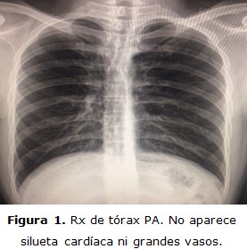 figura 1
