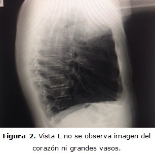 figura 2
