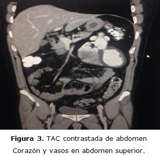 Figura 3