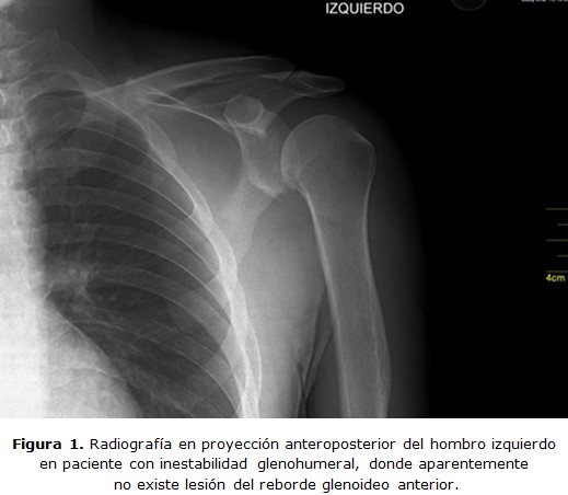 figura 1