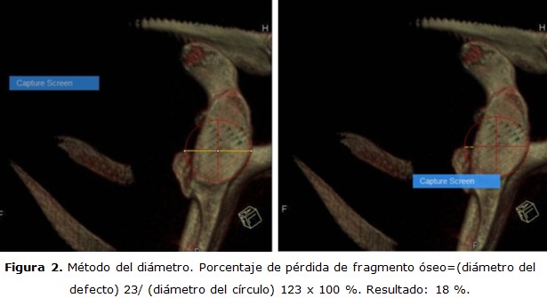 figura 2