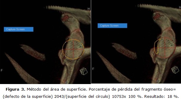 figura 3
