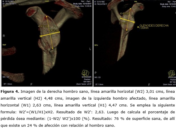 figura 4