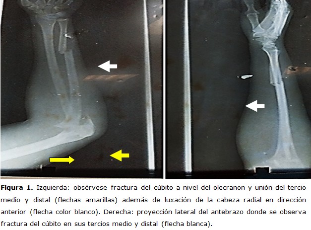 Figura 1