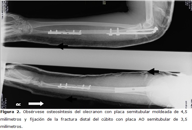 Figura 2