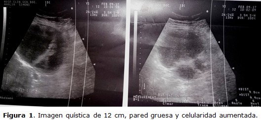 Figura 1