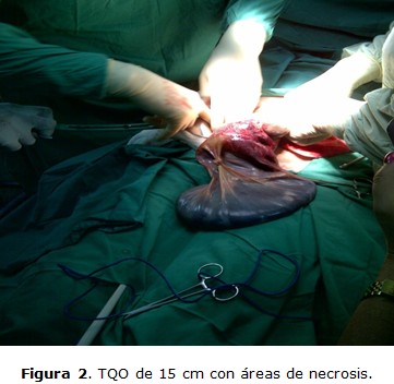 Figura 2