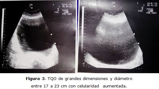 Figura 3