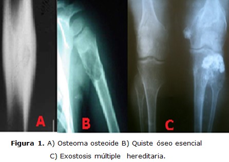 Figura 1