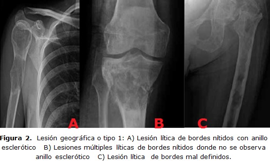 Figura 2