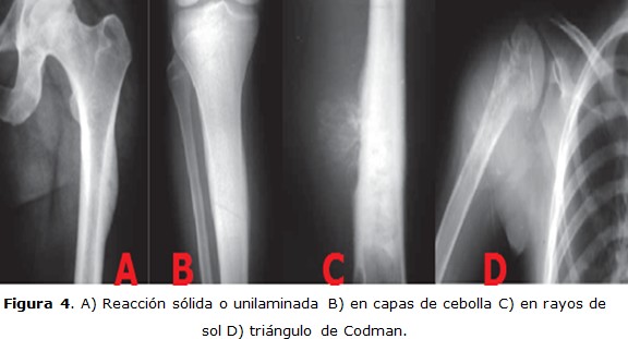 Figura 4