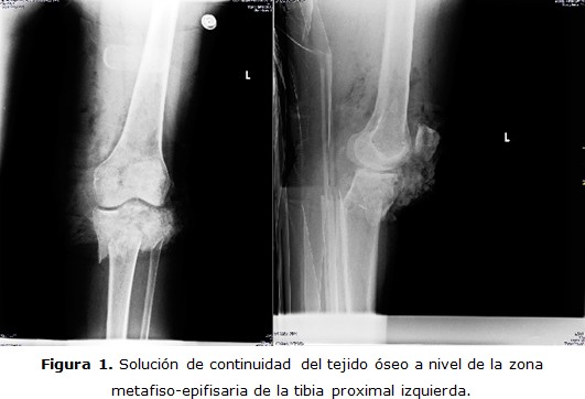 figura 1