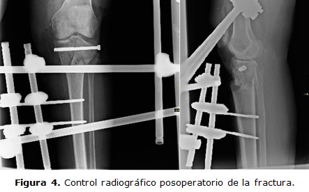 figura 4
