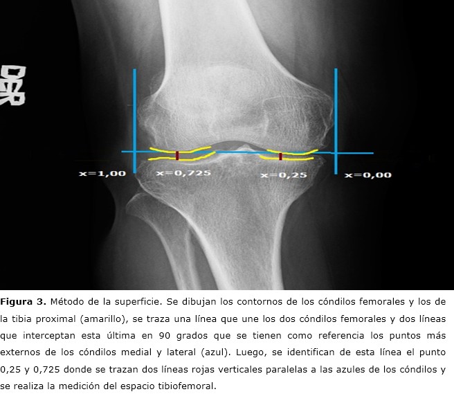 figura 3