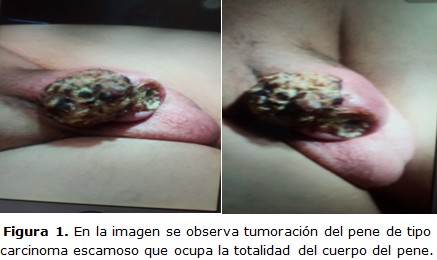 figura 1