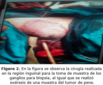 figura 2