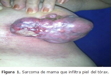 figura 1