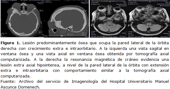 figura 1