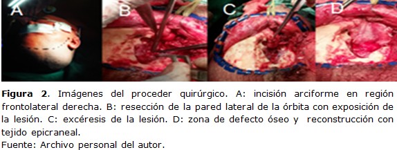 figura 2