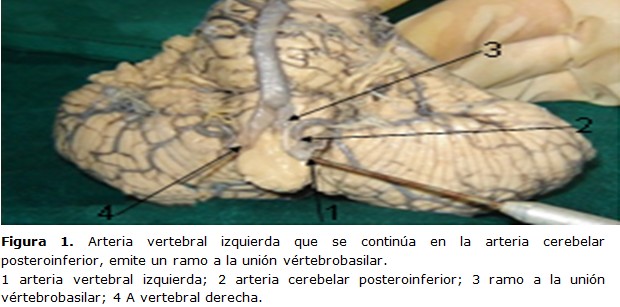 Figura 1