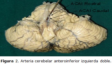 Figura 2