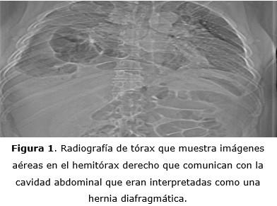 Figura 1