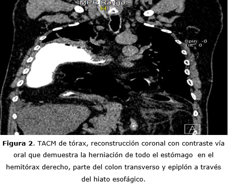 Figura 2