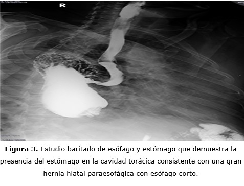 Figura 3