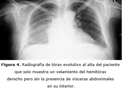Figura 4