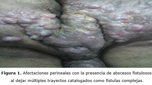 figura 1