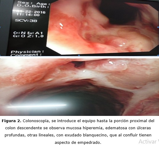 figura 2