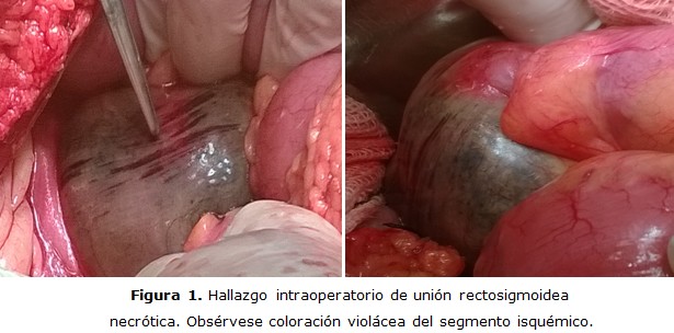 figura 1