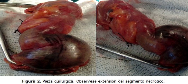 figura 2