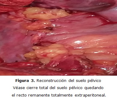 figura 3