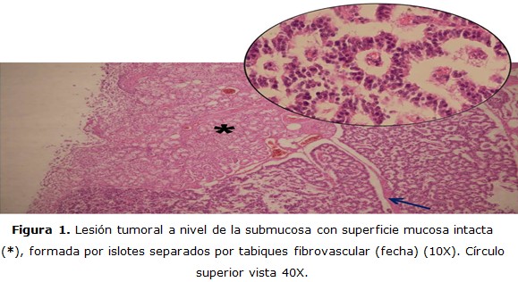 figura 1