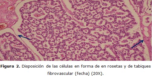 figura 2