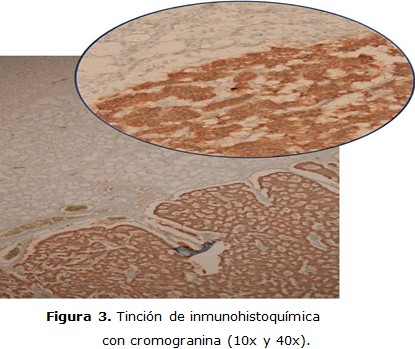figura 3